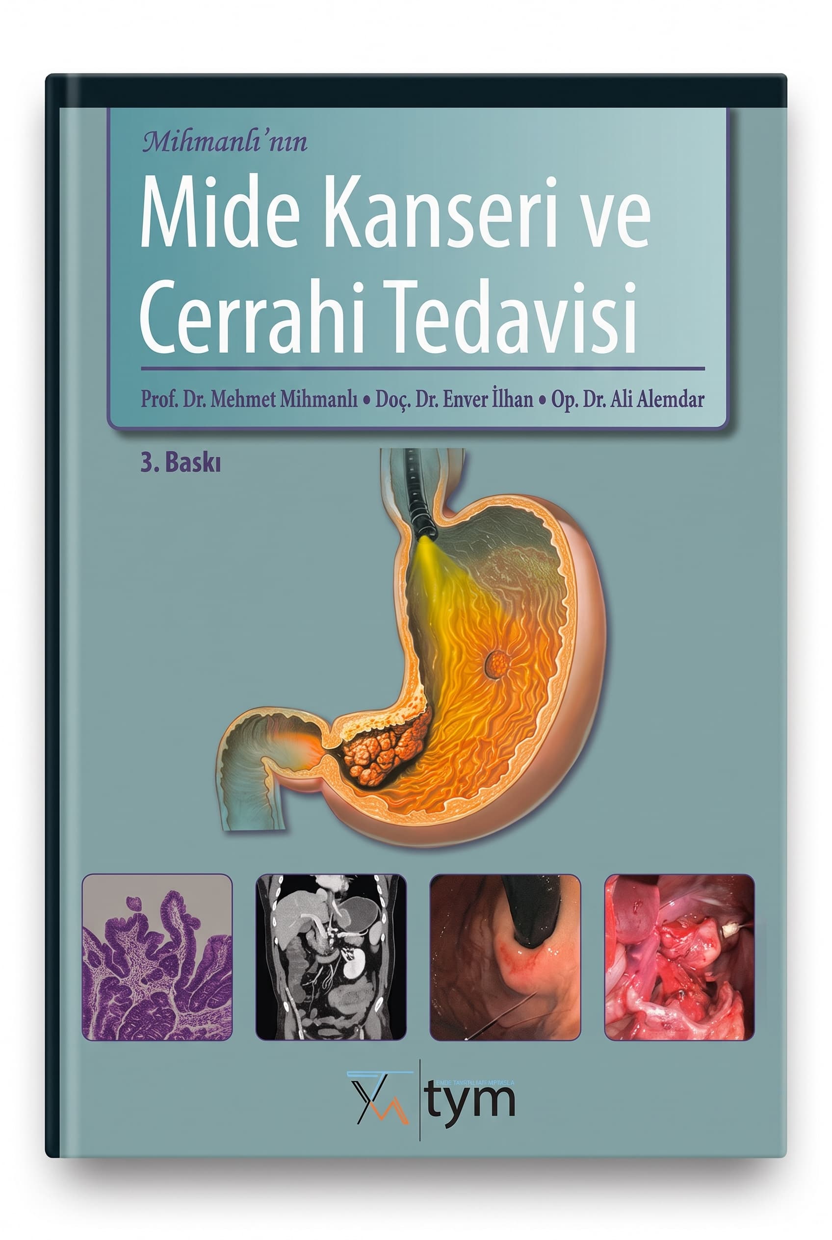 Mide Kanseri ve Cerrahi Tedavisi