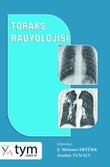 Toraks Radyolojisi