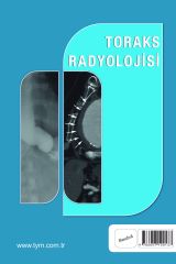 Toraks Radyolojisi