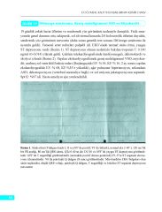 Elektrokardiyografi, Telekardiyografi ve Fizik Muayene ile Doğumsal Kalp Hastalıklarının Klinik Tanısı