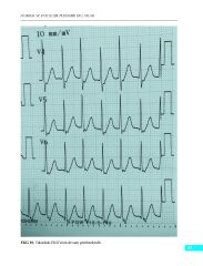 Normal ve Patolojik Pediatrik EKG Atlası
