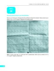 Normal ve Patolojik Pediatrik EKG Atlası