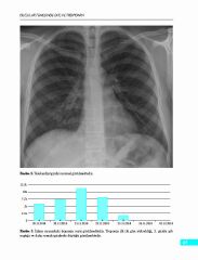 Olgular Temelinde EKG ve Troponin