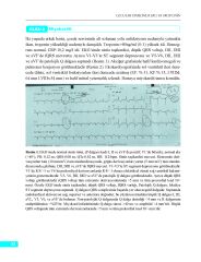 Olgular Temelinde EKG ve Troponin
