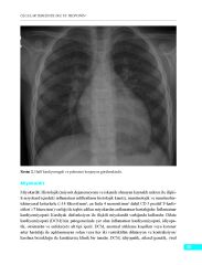 Olgular Temelinde EKG ve Troponin