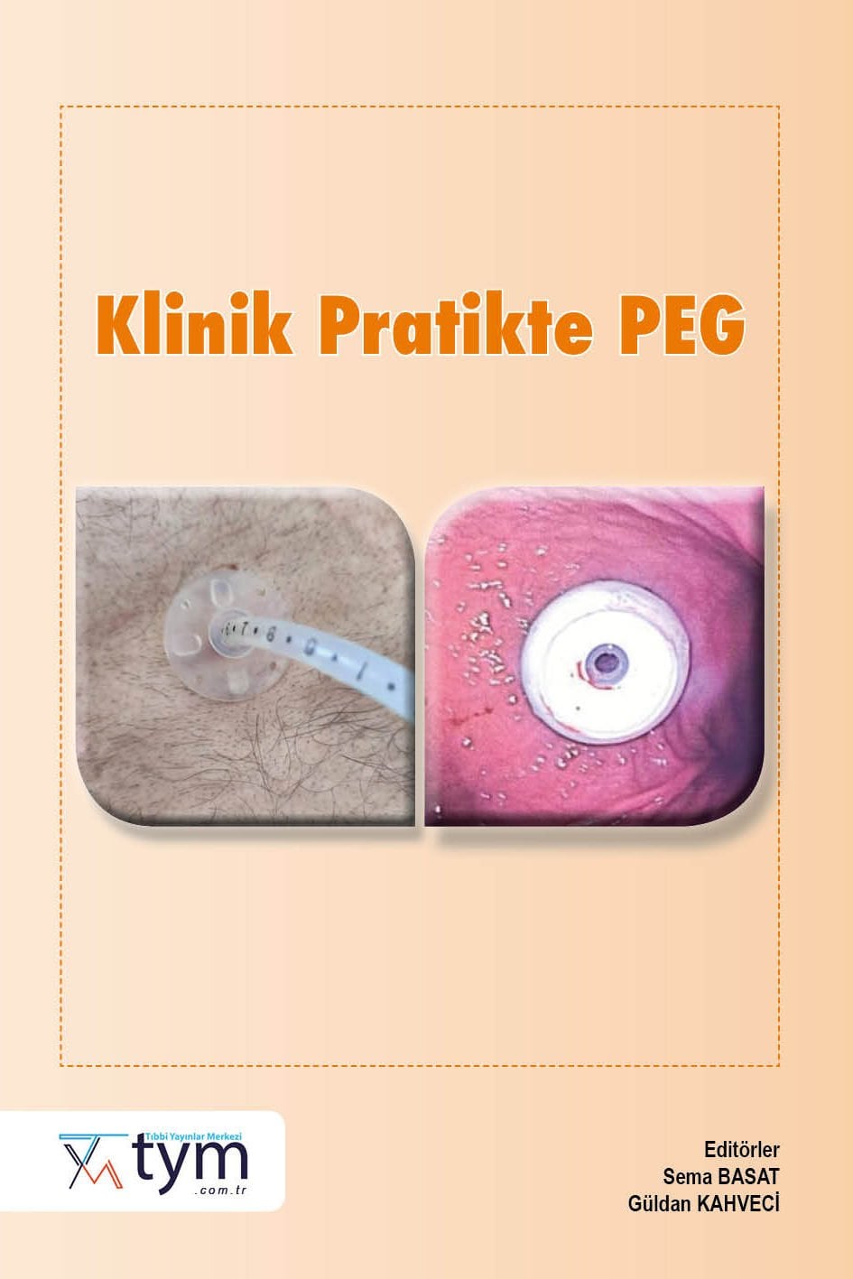 Klinik Pratikte PEG