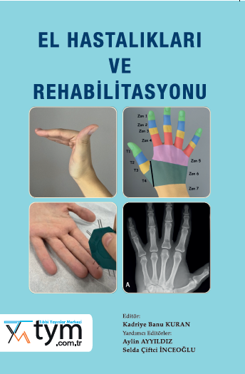 El Hastalıkları ve Rehabilitasyonu