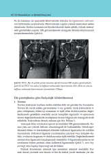 El Hastalıkları ve Rehabilitasyonu