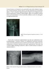 El Hastalıkları ve Rehabilitasyonu