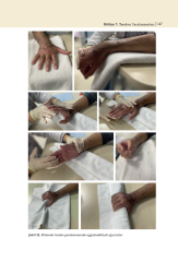 El Hastalıkları ve Rehabilitasyonu