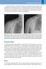 AKROMİYOKLAVİKÜLER EKLEM PROBLEMLERİNE PRATİK YAKLAŞIM